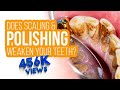 Does Scaling Polishing Weaken Your Teeth Satisfactory Removal Of Heavy Tartar Through US Scalar