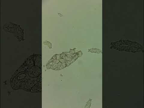 Phylum Tardigrada : Tardigrade Eggs Hatching