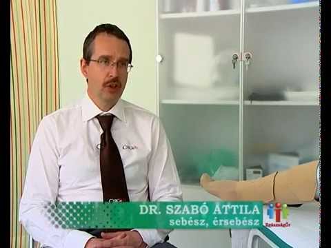 sólyom terápia visszér visszér a lábakon kenőcs kezelés
