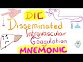 Disseminated Intravascular Coagulation (DIC) | Mnemonic