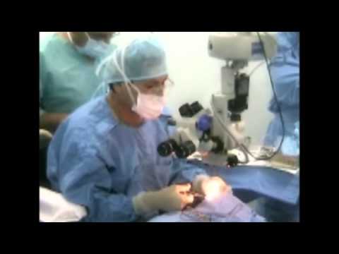 SEGUNDA CAMPAÑA DE OPERACIÓN GRATUITA DE CATARATA