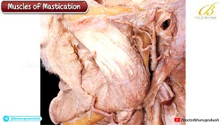 Muscles of Mastication (Cadaveric Anatomy) 🦷 USMLE Step 1/2 CK | Masseter, Temporalis, & Pterygoids