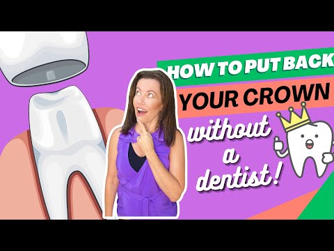 How To Put Your Temporary Crown Back In Place WITHOUT a Dentist!
