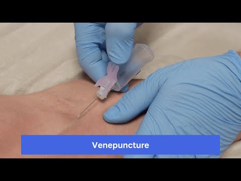 Venepuncture
