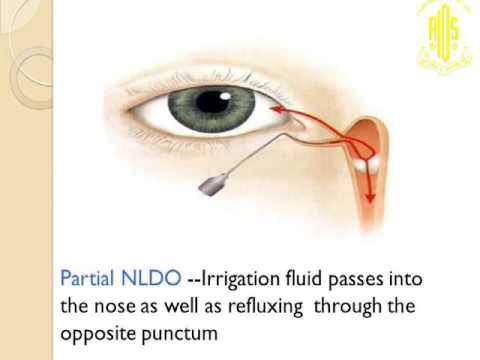 download lagu mp3 mp4 Dr Mukesh Sharma Eye Specialist Jaipur, download lagu Dr Mukesh Sharma Eye Specialist Jaipur gratis, unduh video klip Dr Mukesh Sharma Eye Specialist Jaipur