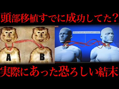 中国、頭部移植を禁止