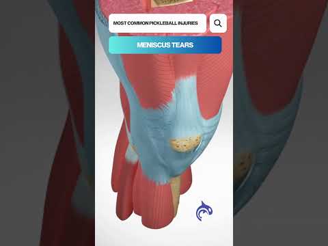 Guess The Spine Injury And Procedure Challenge