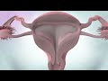 Cancers of the female reproductive system | Cancer Research UK
