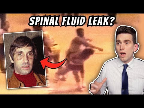 The Untold Side of the Most Infamous Punch in NBA History - Doctor Explains Rudy Tomjanovich Injury