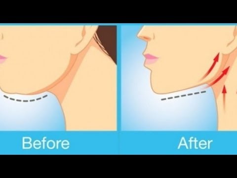 Ay posible na mawalan ng timbang sa ilang mga mansanas Stroke mawalan ng timbang