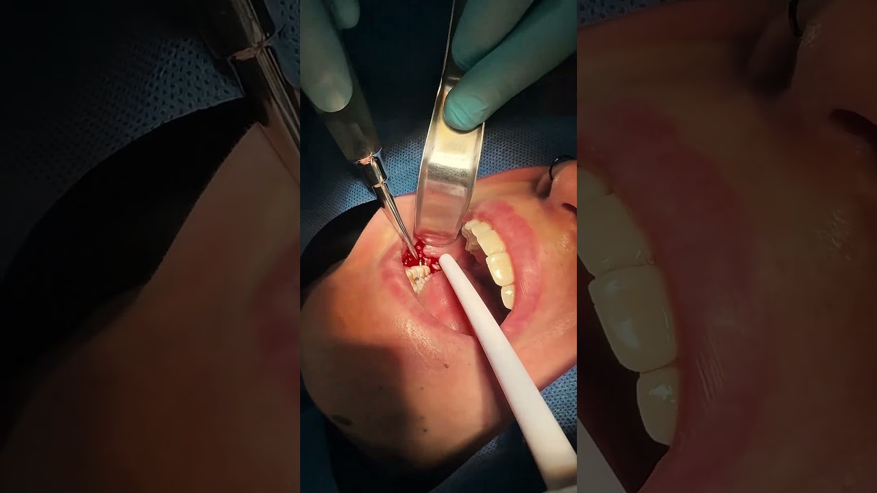 Alejandro Daniel Montiel Garcés-7