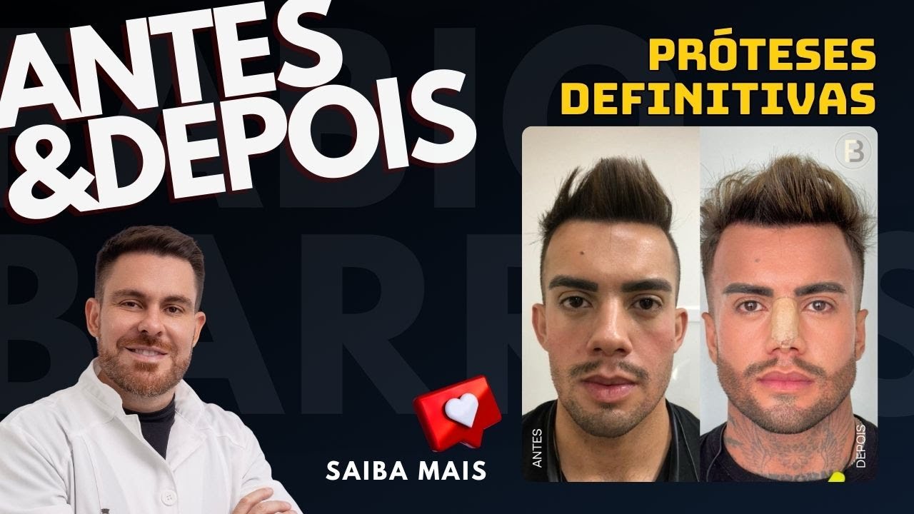 Antes e Depois: Transformações com Próteses Faciais