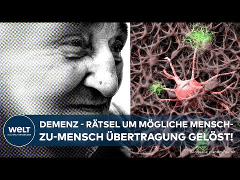 ALZHEIMER: Neue Forschungsergebnisse! Übertragung möglich - es geht keine Gefahr von Erkrankten aus!