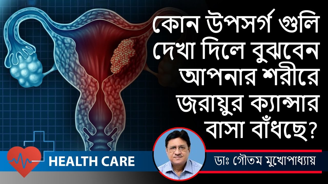 Cervical cancer Symptoms | Treatment -জরায়ু ক্যান্সারের লক্ষণ-Oncologist Dr.Gautam Mukhopadhyay