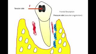 Dental Treatment: Accelerated Orthodontics Jul 14, 2016