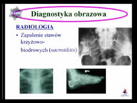 Długo prowadzi femoris Po 40 latach kulturystyka ćwiczenia kompleksy
