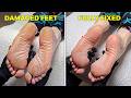My Biggest Pedicure Transformation Challenge Yet