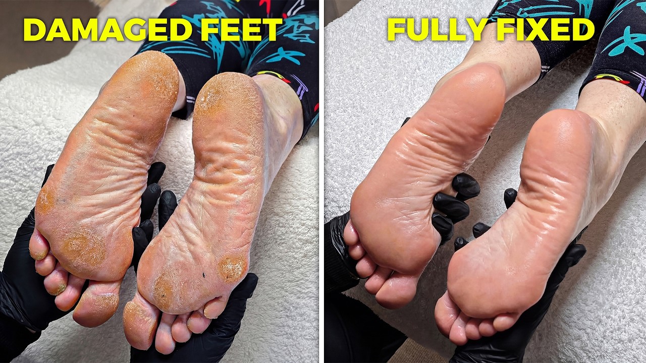 My Biggest Pedicure Transformation Challenge Yet