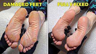 My Biggest Pedicure Transformation Challenge Yet