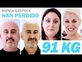 Perder 45 Kilos Con Manga Gástrica Mejores Casos Clínicas Diego De León