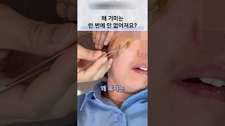 기미와 흑자, 치료 횟수보다 병변의 차이 이해하기
