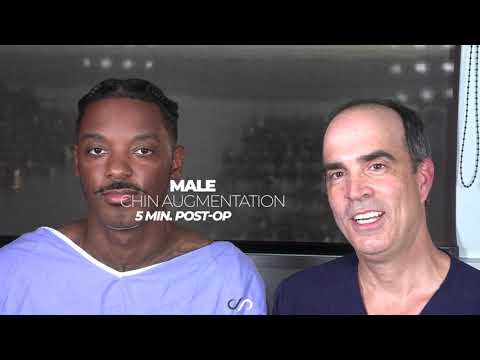 Male Chin Augmentation | Immediate Result | Los Angeles