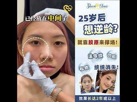 Who Said Sculptra is Only for Older People? | Dr. Doris’s Pro-Aging Secrets for 20s