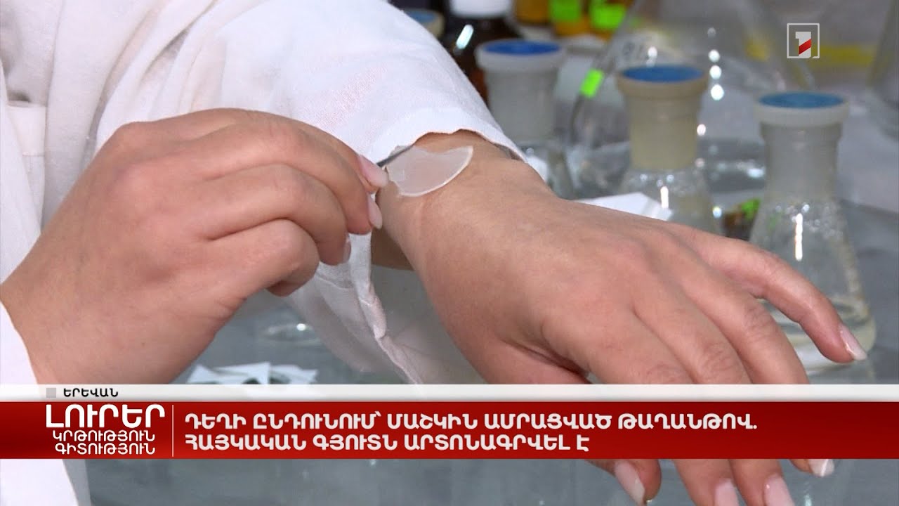 Դեղի ընդունում՝ մաշկին ամրացված թաղանթով. հայկական գյուտն արտոնագրվել է