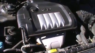 Hyundai Sonata 2.4 Liter Timing Belt/Water Pump Replacement Full-Screen Reupload