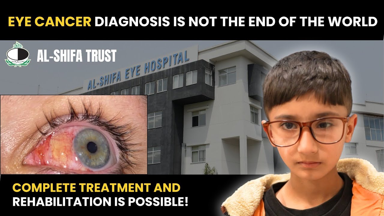 Muhammad Shafay | Eye Cancer Patient | Al-Shifa Trust Eye Hospital