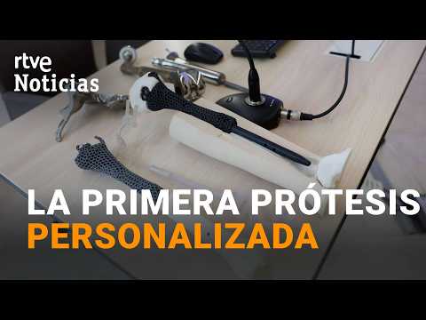 El Gregorio Marañón salva la pierna a un hombre con una prótesis personalizada | RTVE Noticias
