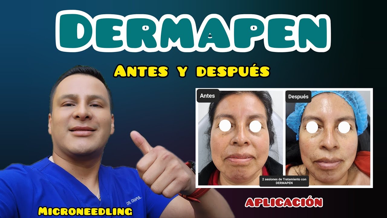 José Luis Muñoz Chapul-43