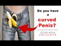 curved penis in telugu bend penis causes and treatment options in hyderabad