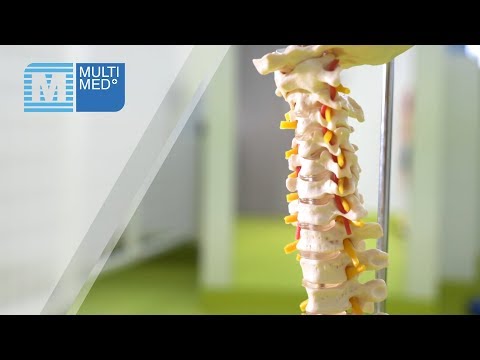 Zwłóknienie mięśnia Spastyczność mięśni po leczeniu udaru