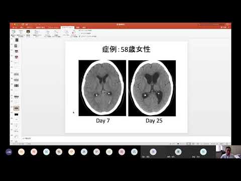 医学科 脳神経外科臨床講義（医学科模擬授業）