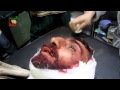 Syria | Douma | An injured Man Takes His Last Breaths | Dec 04, 2012 | 18+ Syria | Douma | An injured Man Takes His Last Breaths | Dec 04, 2012 | 18+