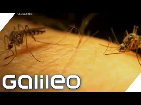 Schmerzen in der Brust und Schmerzen im unteren Rücken Behandlung des Schultergelenks mit zervikaler Osteochondrose