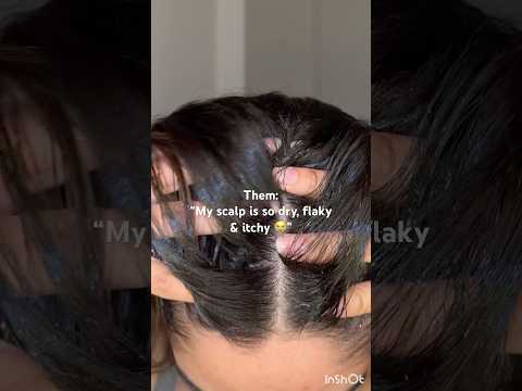 This might be one of the reasons your scalp is so itchy & dry ☝🏼🤯 #hair #haircare #shorts #scalp
