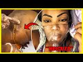 Konjyeresha Amabuno Byamukozeho😱  (Plastic Sugery) || Sibose Bihira! (TheBros)