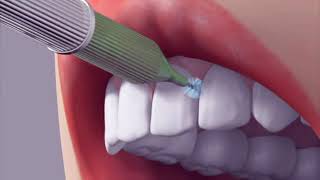 gum arayüz fırçası kullanımı