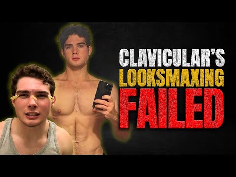 Clavicular’s lookmaxxing journey just got even worse