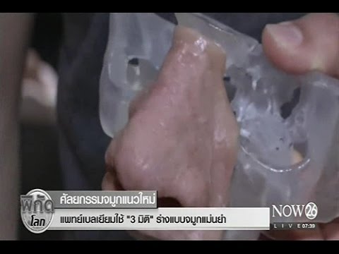 เพิ่มหน้าอกชุด หน้าอกซิลิโคนขนาด 5