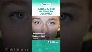 Tanpa Skincare, Berikut Bahan Alami yang Ampuh Menghilangkan Flek Hitam