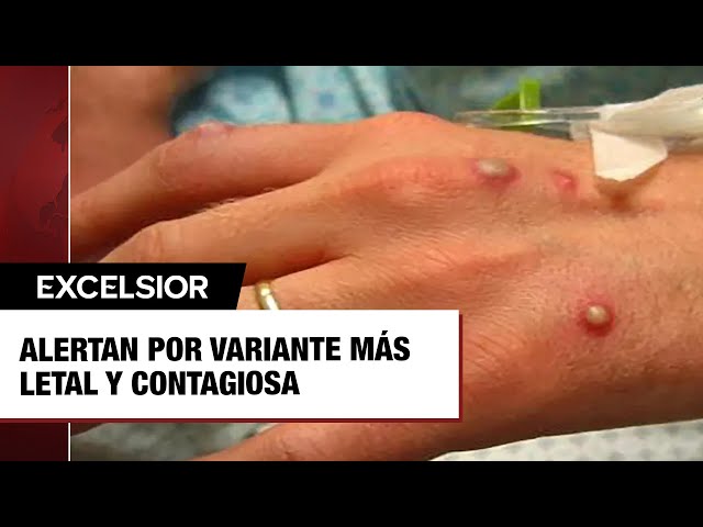 Youtube Imagen