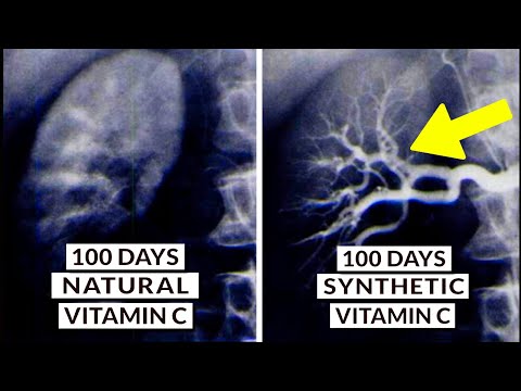 We Finally Know What Type Of Vitamin C Is Best