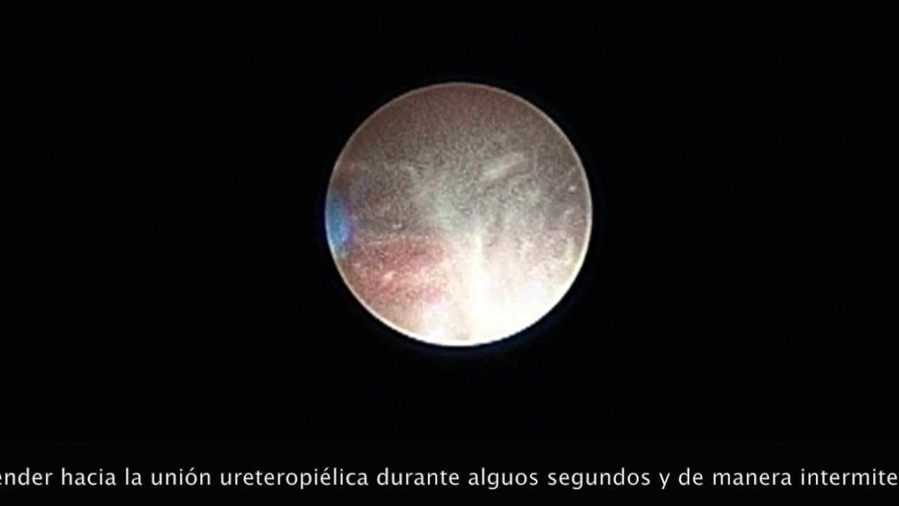 Vicente Enrique De Jesús Cano Pérez-3