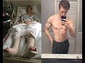 My 2 Years of Progress After Breaking Both My Heel Bones. Age 17-19