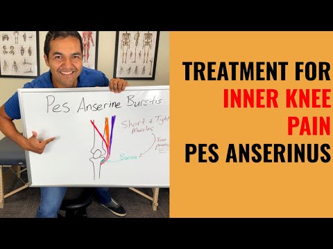 How To Cure Inner Knee Pain Caused By Pes Anserine Bursitis [Easy Self Treatment That Works]
