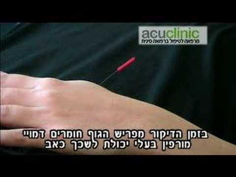 moti chekanover clip dikur fixed