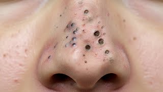 𝑺𝒐𝒐𝒕𝒉𝒊𝒏𝒈 𝑭𝒂𝒄𝒊𝒂𝒍 𝑻𝒓𝒆𝒂𝒕𝒎𝒆𝒏𝒕 𝑭𝒐𝒓 𝑺𝒕𝒓𝒆𝒔𝒔 𝑹𝒆𝒍𝒊𝒆𝒇 𝒂𝒕 𝑳𝒖𝒙𝒖𝒓𝒚 𝑺𝒑𝒂 𝑨𝒄𝒉𝒊𝒆𝒗𝒆 𝑰𝒏𝒏𝒆𝒓 𝑷𝒆𝒂𝒄𝒆 #500369